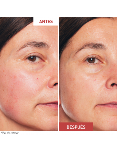 ERBORIAN SKIN THERAPHY SERUM EN ACEITE 30ML