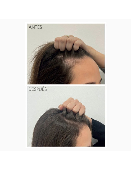 MONCHO MORENO RAPUNHAIR PREBIOTIC BOOSTER 70ML