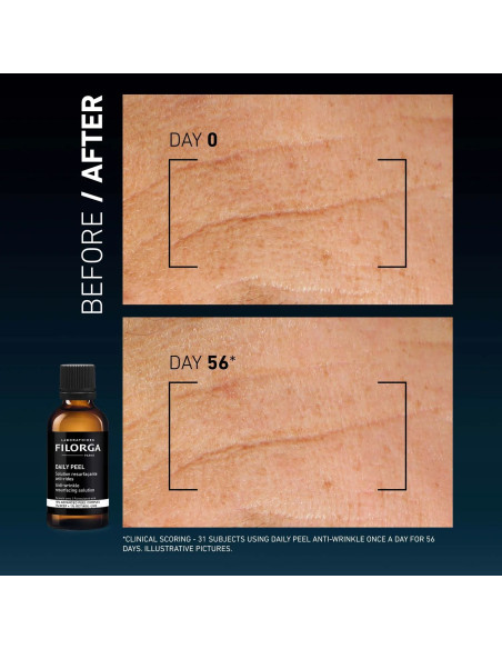 FILORGA DAILY PEEL SOLUCION RENOVADORA ANTIMANCHAS 50ML