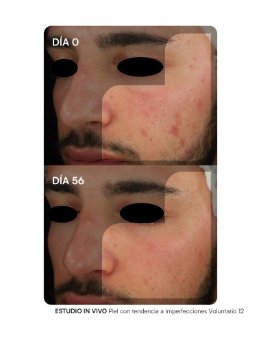 GEMA HERRERIAS PROBIODERM BALANCE COMPLEMENTO...