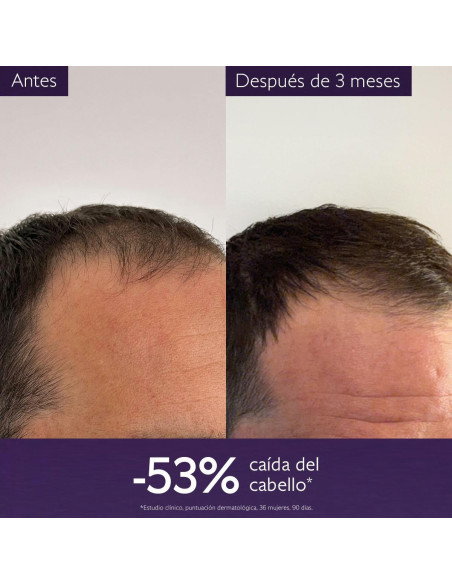 CAUDALIE SERUM CAPILAR ANTICAIDA 50ML